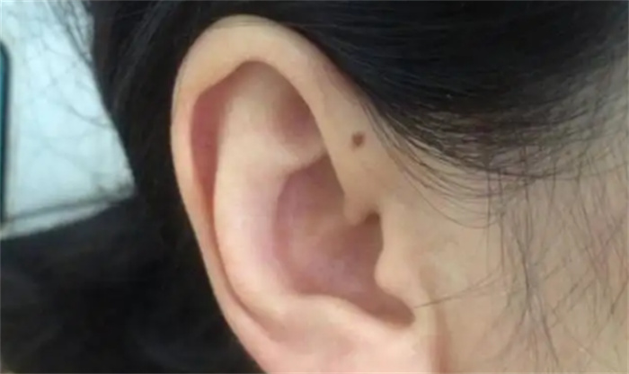 Ůyõ4wFʲôҶL(zhng)룩