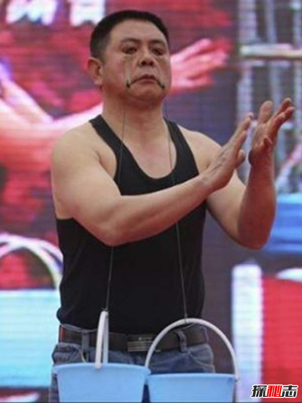 世界上十大最古怪的男人,20歲小伙沒有臉可以活兩年